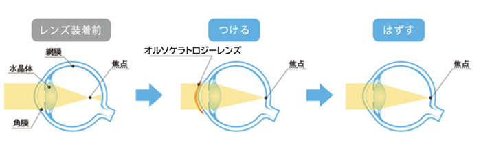 レンズ装着前・装着中・脱着後の図