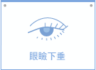 眼瞼下垂